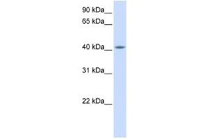 FAM54A antibody used at 1 ug/ml to detect target protein.