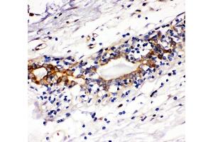 IHC analysis of Kit using anti-Kit antibody (ABIN7825521). (KIT anticorps  (C-Term))