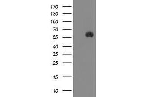 Image no. 1 for anti-serine Peptidase Inhibitor, Kunitz Type 1 (SPINT1) antibody (ABIN1501110) (SPINT1 anticorps)