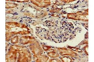 Immunohistochemistry of paraffin-embedded human kidney tissue using ABIN7164288 at dilution of 1:100