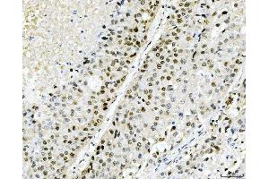 IHC analysis of Cyclophilin E/PPIE using anti-Cyclophilin E/PPIE antibody (ABIN7599242). (PPIE anticorps  (AA 1-301))