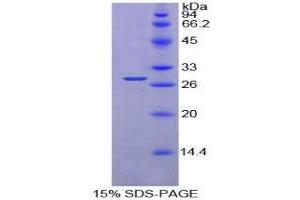 SDS-PAGE (SDS) image for Prolyl 4-Hydroxylase, beta Polypeptide (P4HB) (AA 46-258) protein (His tag) (ABIN1879400)