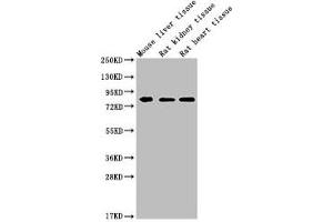 Western Blot Positive WB detected in: MMUT antibody at 1:1000 Lane 1: Mouse liver tissue Lane 2: Rat kidney tissue Lane 3: Rat heart tissue Secondary Goat polyclonal to Mouse IgG at 1/20000 dilution Predicted band size: 83 KDa Observed band size: 83 KDa Exposure time: 5 min (MMUT (AA 31-748) anticorps)