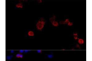 Immunofluorescence analysis of NIH/3T3 cells using FLNB Polyclonal Antibody at dilution of 1:100 (40x lens).