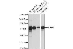 Western blot analysis of extracts of various cell lines, using HOXD3 antibody (ABIN6290493) at 1:1000 dilution. (HOXD3 anticorps)