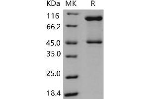 Western Blotting (WB) image for serpin Peptidase Inhibitor, Clade B (Ovalbumin), Member 3 (SERPINB3) protein (His tag) (ABIN7320213)