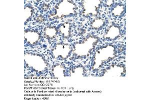 Rabbit Anti-EMP2 Antibody  Paraffin Embedded Tissue: Human Lung Cellular Data: Alveolar cells Antibody Concentration: 4. (EMP2 anticorps  (Middle Region))