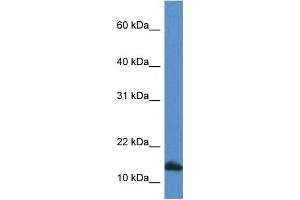 Western Blot showing CDA antibody used at a concentration of 1 ug/ml against HepG2 Cell Lysate (CDA anticorps  (C-Term))