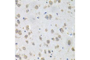 Immunohistochemistry of paraffin-embedded mouse brain using GNE antibody (ABIN5996449) at dilution of 1/100 (40x lens). (GNE anticorps)