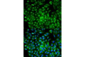 Immunofluorescence analysis of A549 cell using ATG16L1 antibody. (ATG16L1 anticorps  (AA 90-300))