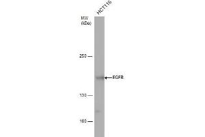 WB Image EGFR antibody detects EGFR protein by western blot analysis. (EGFR anticorps  (N-Term))