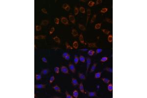Immunofluorescence analysis of L929 cells using TCIRG1 Polyclonal Antibody (ABIN7270707) at dilution of 1:100 (40x lens). (TCIRG1 anticorps  (AA 1-130))