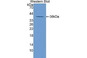 Western blot analysis of the recombinant protein. (LDHB anticorps  (AA 1-334))
