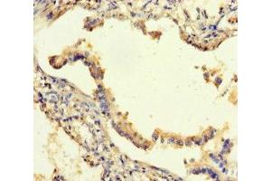 Immunohistochemistry of paraffin-embedded human lung tissue using ABIN7168811 at dilution of 1:100
