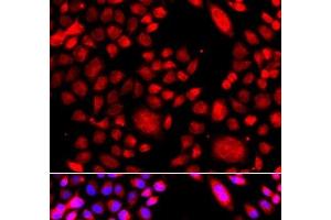 Immunofluorescence analysis of A549 cells using RAC3 Polyclonal Antibody