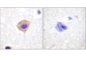 Immunohistochemistry analysis of paraffin-embedded human brain tissue, using Catalase (Ab-385) Antibody. (Catalase anticorps  (AA 361-410))
