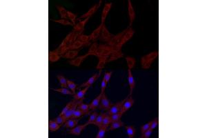 anti-Polo-Like Kinase 2 (PLK2) (AA 322-671) antibody