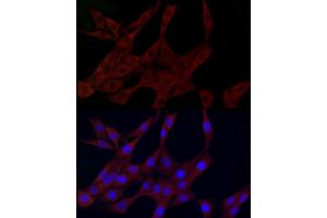 Immunofluorescence analysis of PC-12 cells using PLK2 Rabbit pAb (ABIN6132905, ABIN6145776, ABIN6145778 and ABIN6222860) at dilution of 1:150 (40x lens). (PLK2 anticorps  (AA 322-671))