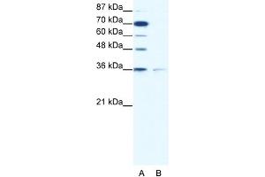 WB Suggested Anti-ZNF326 Antibody Titration: 1. (ZNF326 anticorps  (C-Term))