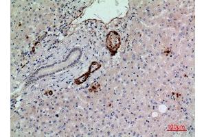 Immunohistochemistry (IHC) analysis of paraffin-embedded Human Liver, antibody was diluted at 1:100. (RHAG anticorps  (N-Term))