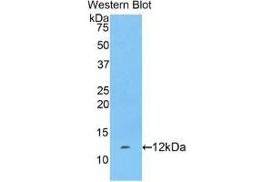 Western blot analysis of the recombinant protein. (FGA anticorps  (AA 554-655))