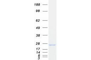 Validation with Western Blot