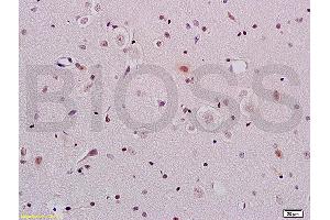 Formalin-fixed and paraffin embedded rat brain tissue labeled with Anti-ERCC1 Polyclonal Antibody, Unconjugated (ABIN733553) at 1:200 followed by conjugation to the secondary antibody and DAB staining (ERCC1 anticorps  (AA 151-250))