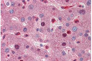 Human Liver: Formalin-Fixed, Paraffin-Embedded (FFPE)