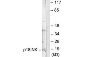 Western blot analysis of extracts from COS7 cells, using p18 INK Antibody. (P18 INK anticorps  (AA 111-160))