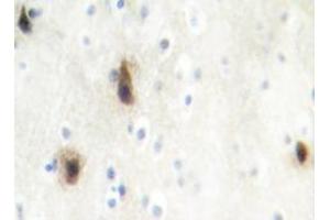 Immunohistochemistry analyzes of MVK antibody in paraffin-embedded human brain tissue. (MVK anticorps)