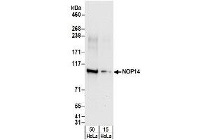 anti-NOP14 Nucleolar Protein (Nop14) (AA 50-100) antibody