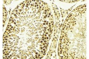 ABIN6267669 at 1/100 staining Mouse testis tissue by IHC-P. (CAMK4 anticorps  (pThr200))