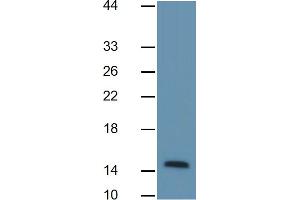 Mouse Capture antibody from the kit in WB with Positive Control: Human Heart lysate. (FABP4 Kit ELISA)