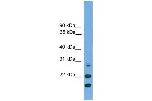 WB Suggested Anti-ASF1A Antibody Titration: 0. (ASF1A anticorps  (N-Term))