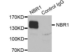 Immunoprecipitation analysis of extracts of K562 cells, using NBR1 antibody (ABIN5972123). (NBR1 anticorps)