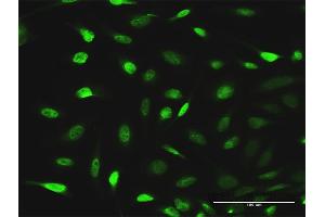 Immunofluorescence of purified MaxPab antibody to EPB41L1 on HeLa cell. (EPB41L1 anticorps  (AA 1-779))