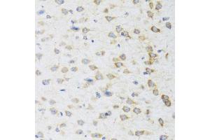 Immunohistochemistry of paraffin-embedded mouse brain using STRN antibody (ABIN5975752) at dilution of 1/100 (40x lens). (Striatin anticorps)