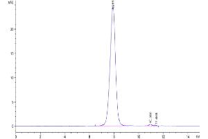 The purity of SARS-CoV-2 Spike S1 (Gamma P.