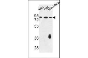 Western blot analysis of F12 Antibody (N-term) in K562,CEM,MDA-MB435 cell line lysates (35ug/lane). (F12 anticorps  (N-Term))