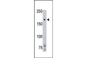 The anti-PTPgamma Center Pab (ABIN392836 and ABIN2842261) is used in Western blot to detect PTPgamma in mouse brain tissue lysate.