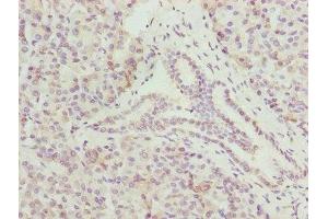 Immunohistochemistry of paraffin-embedded human pancreatic tissue using ABIN7148645 at dilution of 1:100 (CMC1 anticorps  (AA 1-106))