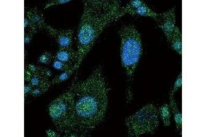 Confocal immunofluorescent analysis of NOTCH3 antibody with HepG2 cells followed by Alexa Fluor 488-conjugated goat anti-rabbit lgG (green).