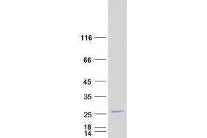 Validation with Western Blot