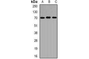 Western blot analysis of ALAS-H expression in SW620 (A), HepG2 (B), mouse liver (C) whole cell lysates. (ALAS1 anticorps)