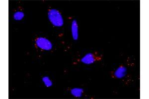Proximity Ligation Analysis of protein-protein interactions between PTK2 and PLCG1.