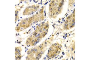 Immunohistochemistry of paraffin-embedded Human gastric using PRG2 antibody at dilution of 1:100 (x400 lens).