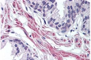 Human Prostate (formalin-fixed, paraffin-embedded) stained with FNTA antibody ABIN298038 at 10 ug/ml followed by biotinylated goat anti-rabbit IgG secondary antibody ABIN481713, alkaline phosphatase-streptavidin and chromogen. (FNTA anticorps  (AA 150-250))
