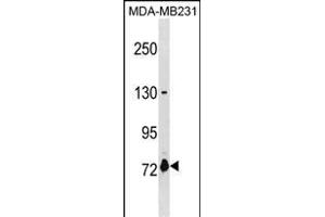 ASNSD1 Antibody (Center) (ABIN1881075 and ABIN2838601) western blot analysis in MDA-M cell line lysates (35 μg/lane). (ASNSD1 anticorps  (AA 380-406))