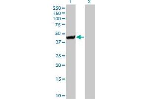 Western Blot analysis of CTH expression in transfected 293T cell line by CTH monoclonal antibody (M01A), clone 4E1-1B7. (CTH anticorps  (AA 1-405))