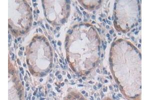 Detection of OAS2 in Human Stomach Tissue using Polyclonal Antibody to 2',5'-Oligoadenylate Synthetase 2 (OAS2)